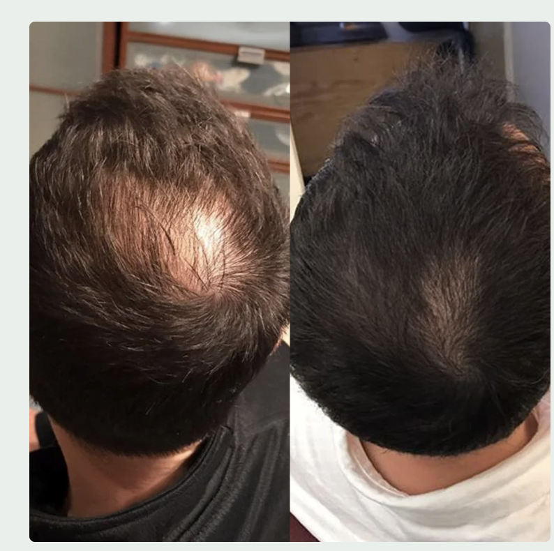 Before and after results from Jason M.